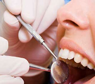 ROOT-CANAL-TREATMENT